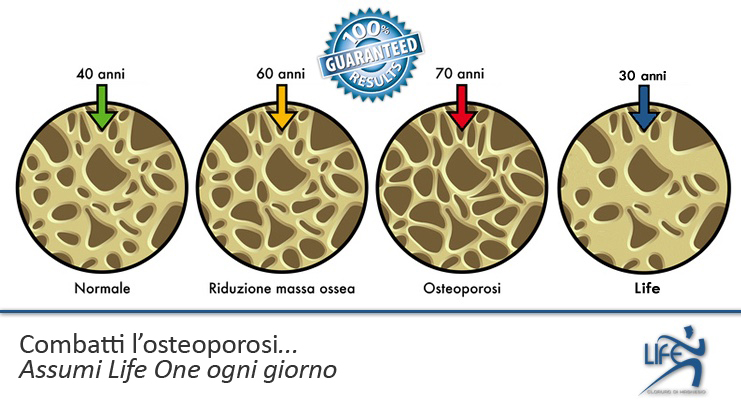 Combatti l'osteoporosi con il magnesio - Life cloruro di magnesio